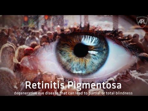 Retinitis Pigmentosa