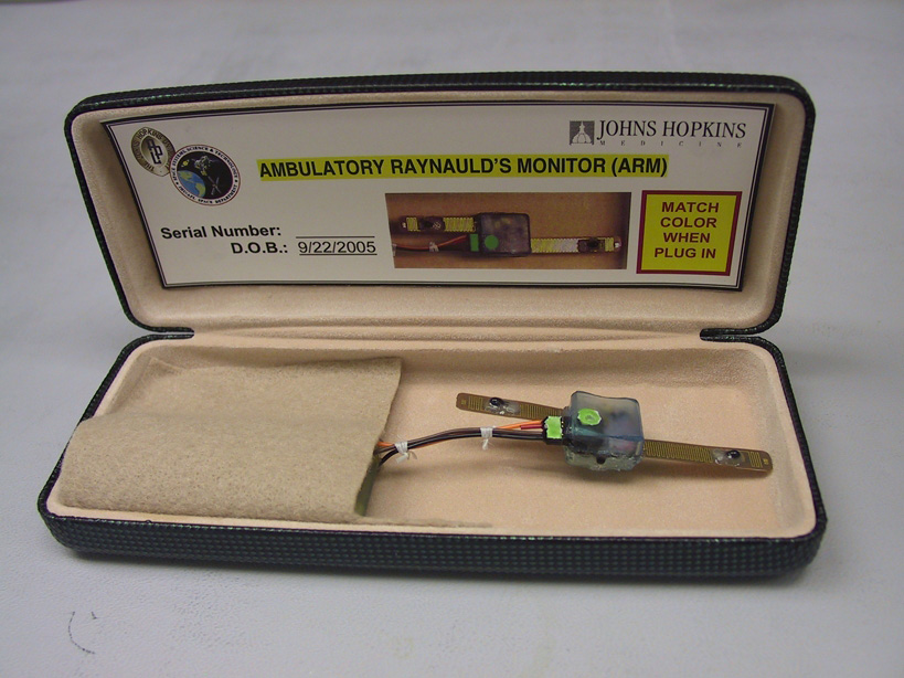 The Ambulatory Raynaud's Monitor, approximately 9/16 of an inch in length, is shown here in its carrying case