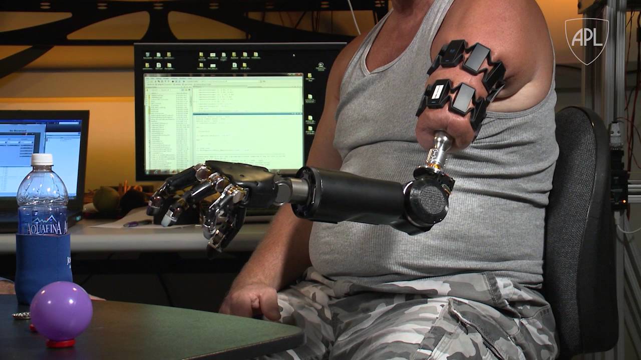 APL's Modular Prosthetic Limb