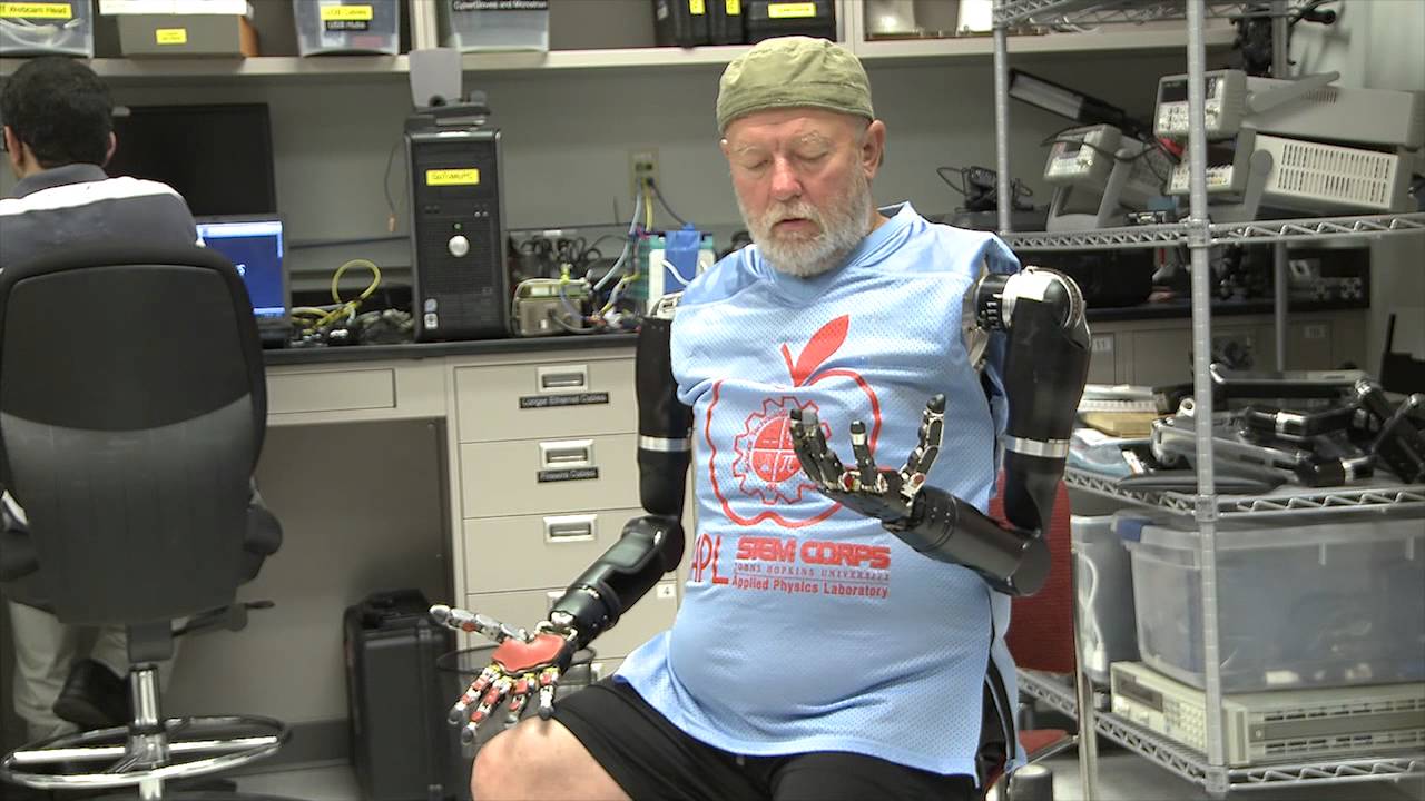 Amputee Makes History with APL's Modular Prosthetic Limb