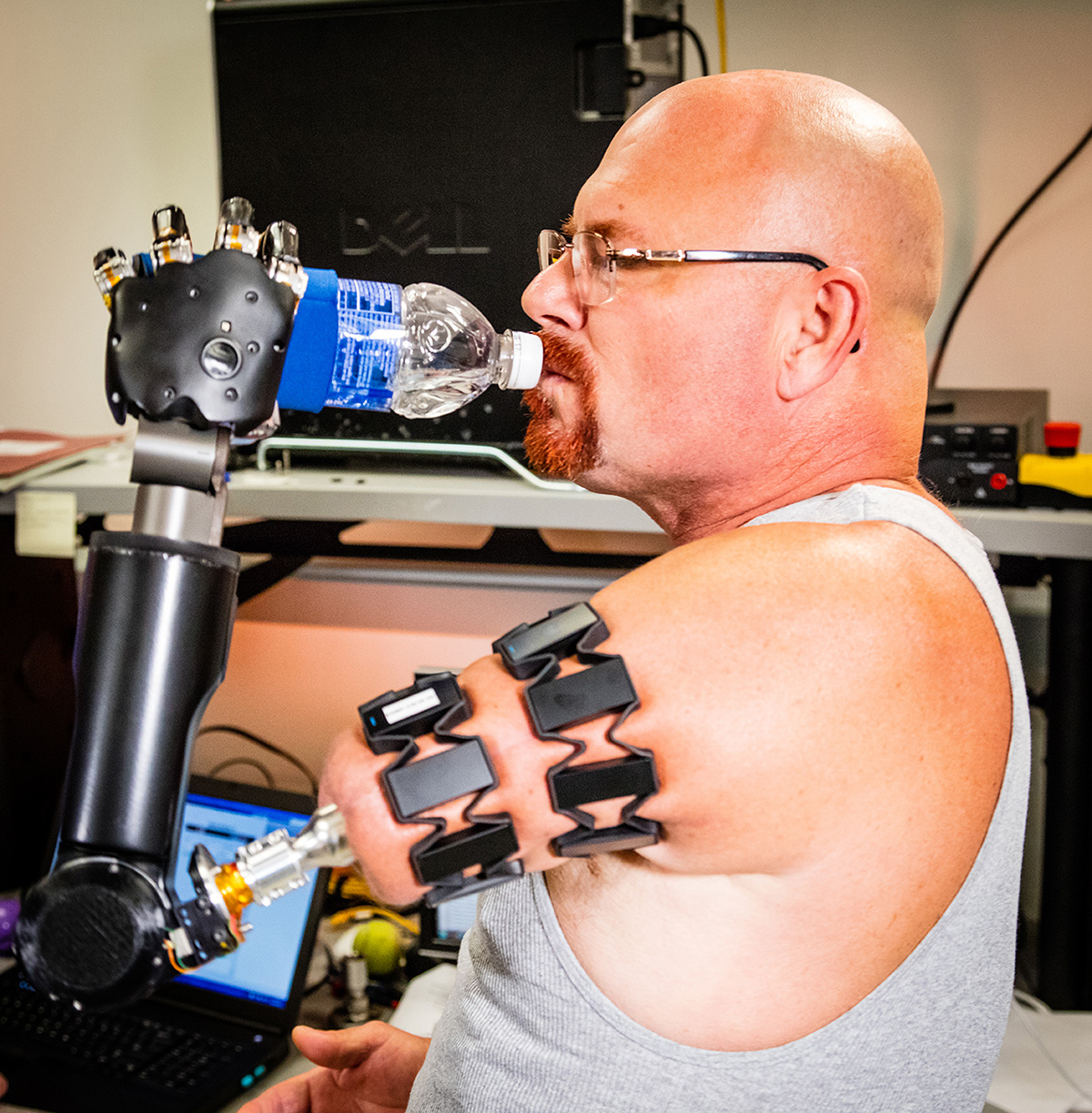 Modular Prosthetic Limb