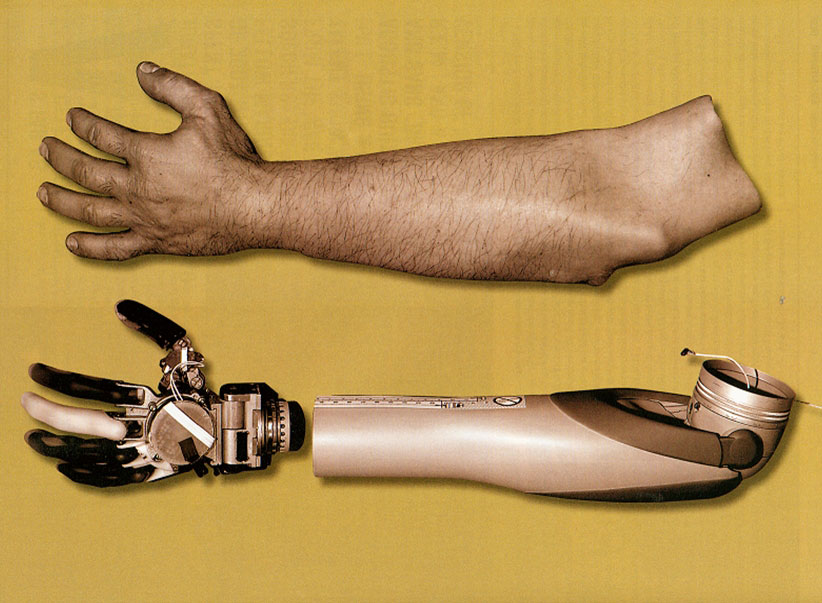 Proto 1 limb system