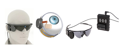 retinal prosthesis